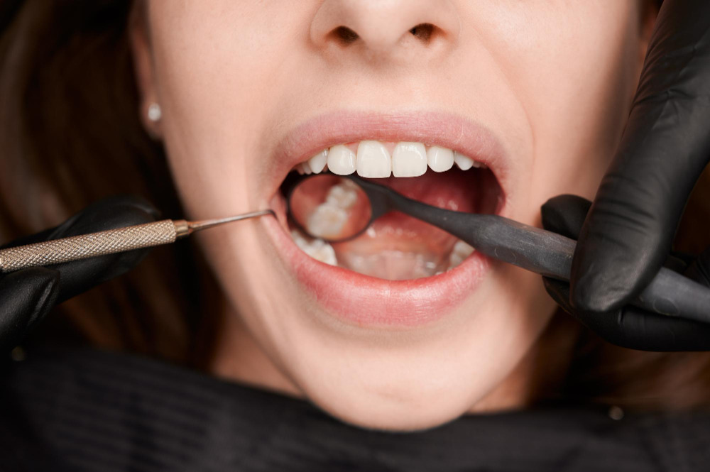 Patient smiling with clear aligners showing natural teeth