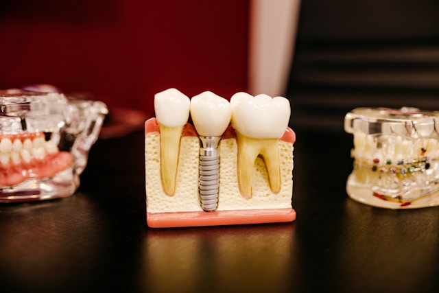 Orthodontist reviewing dental X-ray with patient