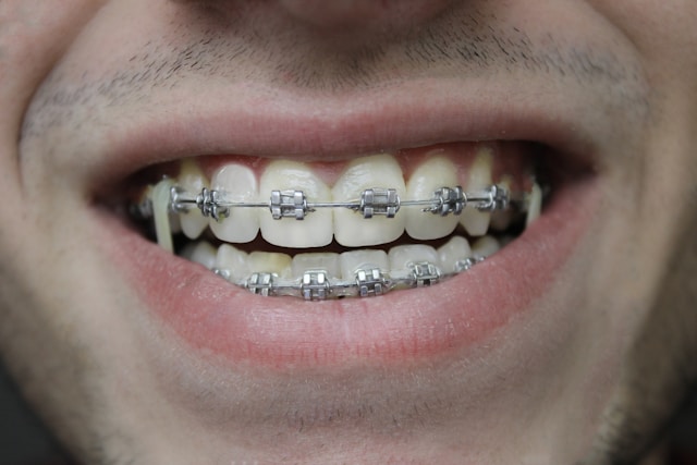Close-up of perfect smile showing aligned white teeth
