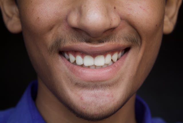 Professional male smiling warmly after smile makeover